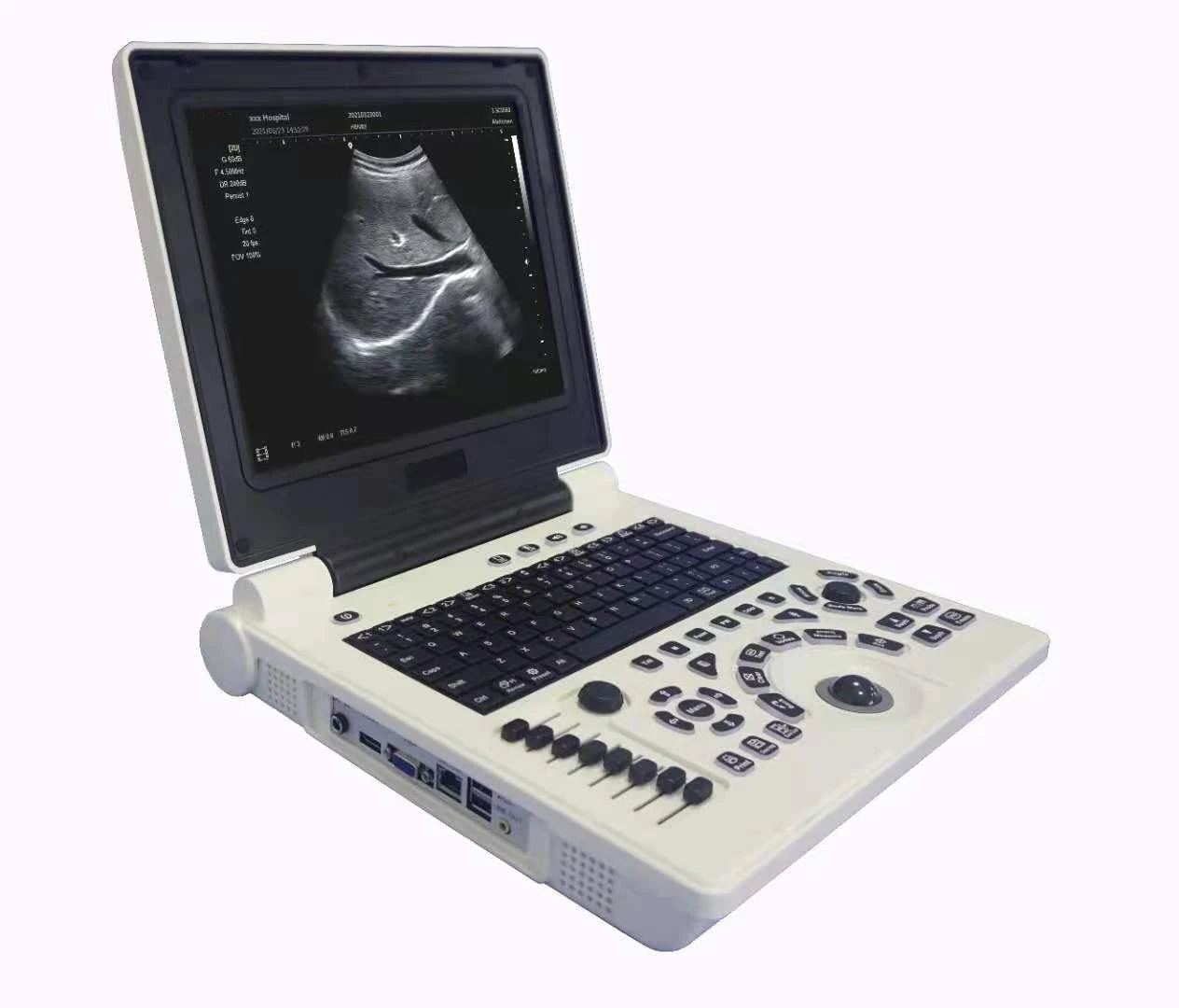 3D Color Doppler Ultrasound Scanner With Convex Probe 3D Color Doppler Ultrasound Scanner With Convex Probe