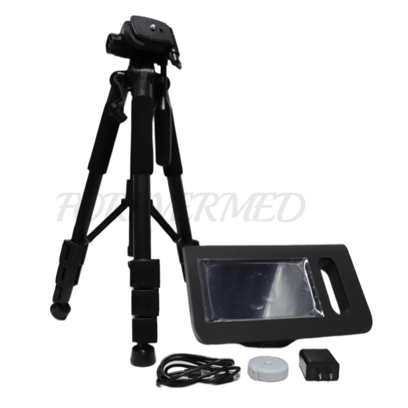 AI Optic Vision Screener