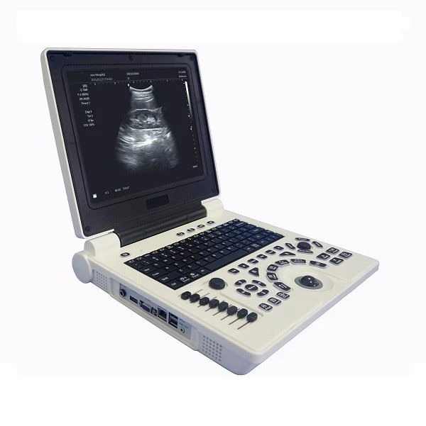 3D barva doppler ultrazvočni skener s konveksno sondo