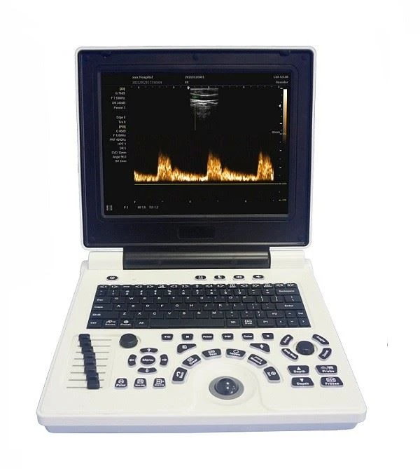 3D Color Doppler Ultrasound Scanner With Convex Probe
