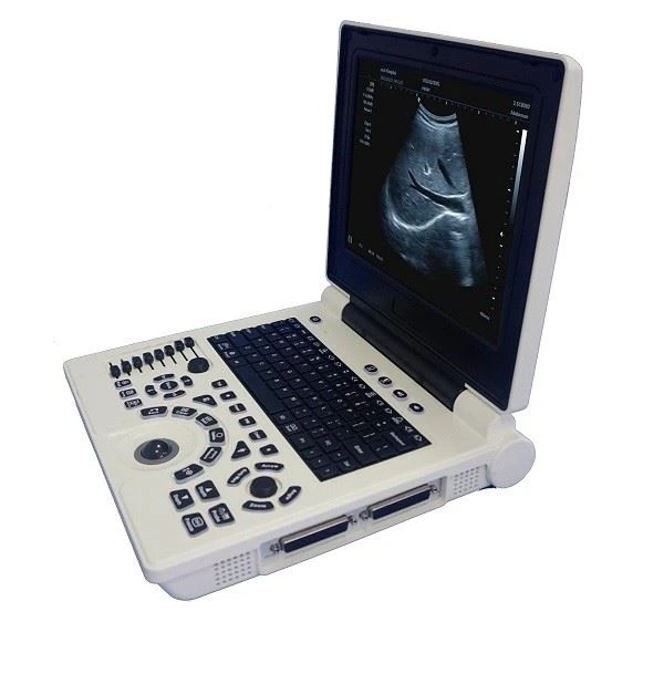 3D Color Doppler Ultrasound Scanner With Convex Probe