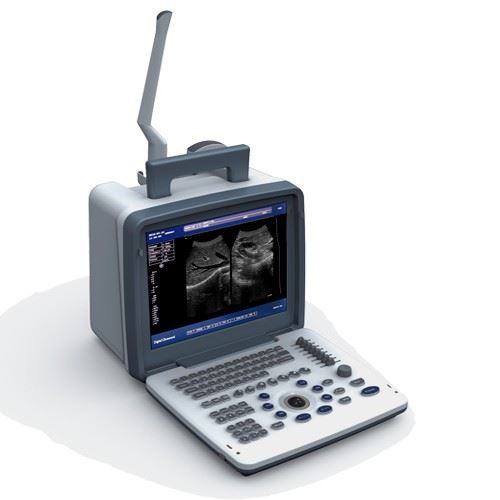 Popoln digitalni UItrazvočni diagnostični sistem