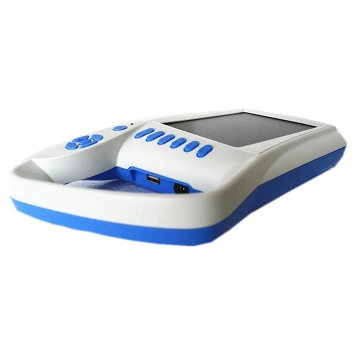 Full Digital Palm Ultrasound Scanner